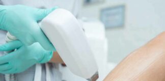 Can Insurance Cover Laser Hair Removal